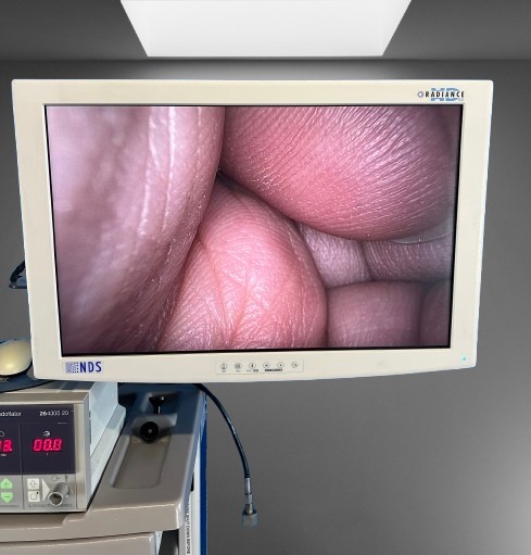 Karl Storz H3Z Camera Head