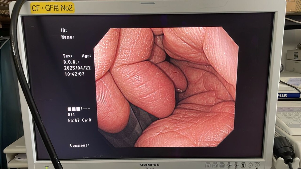 Endoscopy Set : Package Deal for Vets