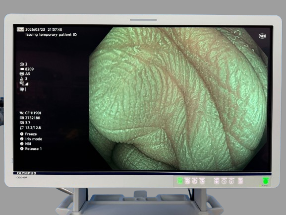 Olympus™ CF H190I : EVIS EXERA III, CLV-190 Scope Lenght: 1.3m length Biopsy channel of 3.7mm
